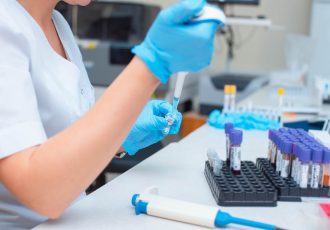 Blood test in the laboratory. Laboratory assistant working with the dispenser. Vacuum tubes with blood.